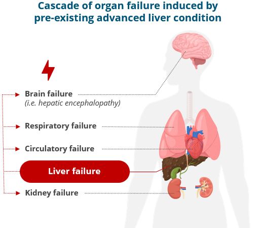 2023.02 GFT Corporate deck - ACLF - MoD EN.jpg