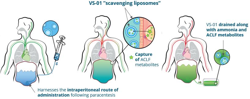 2023.02 GFT Corporate deck - ACLF - VS01 MoA EN.jpg